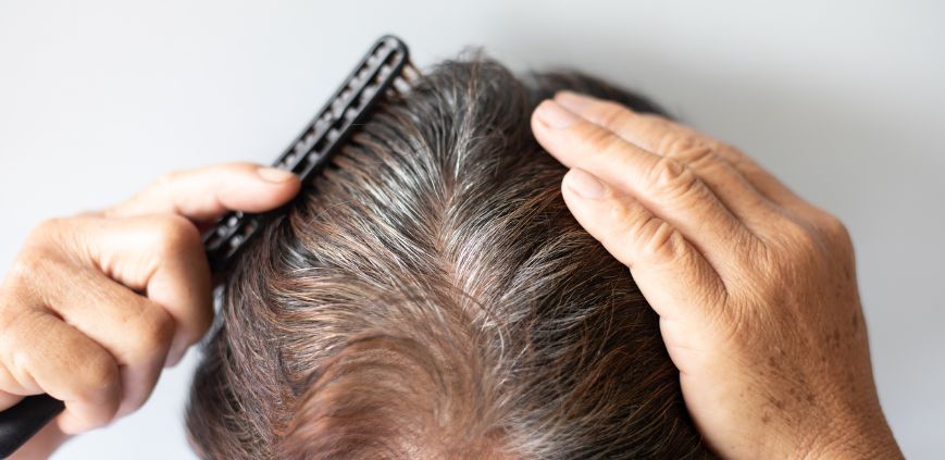 hair growth supplements