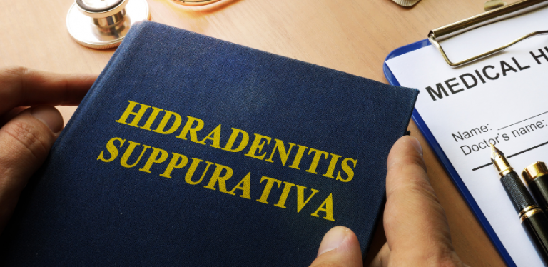 Hidradenitis Suppurativa