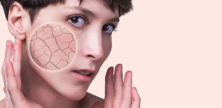 dry skin on the face