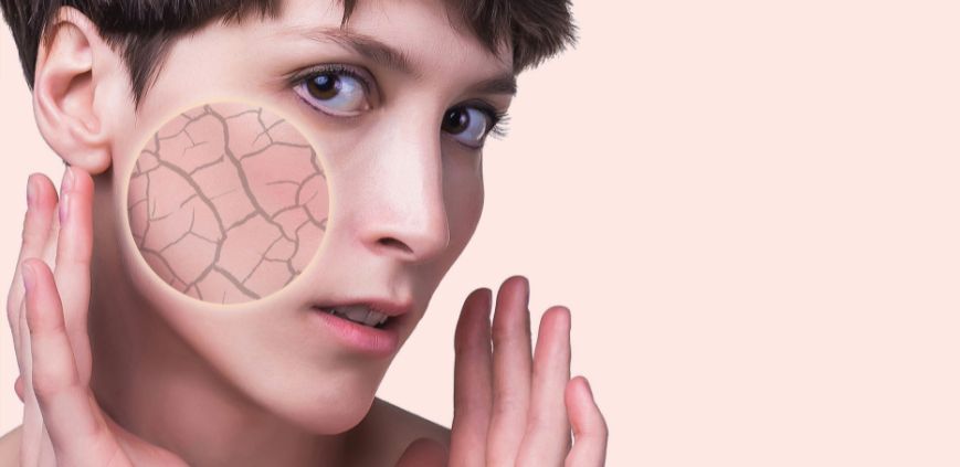 dry skin on the face