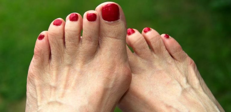 shoes for bunions