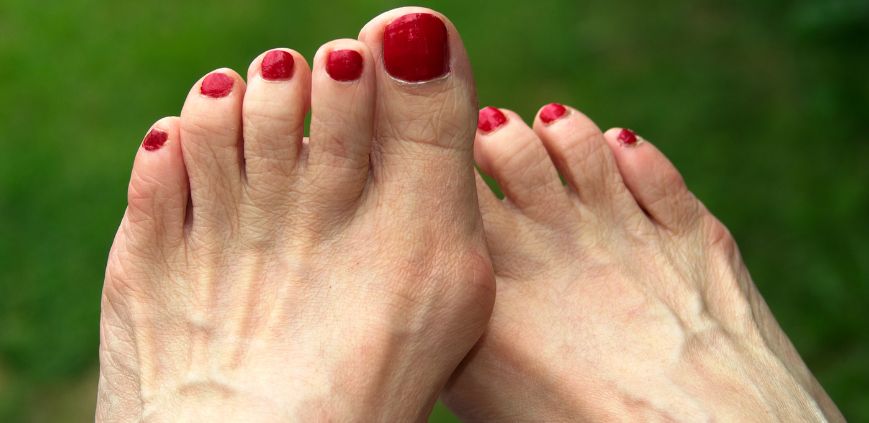shoes for bunions
