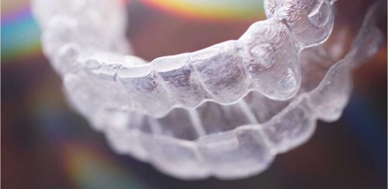 how does Invisalign work