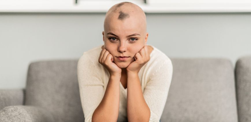 foods for alopecia areata